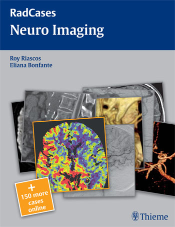 RadCases Neuro Imag