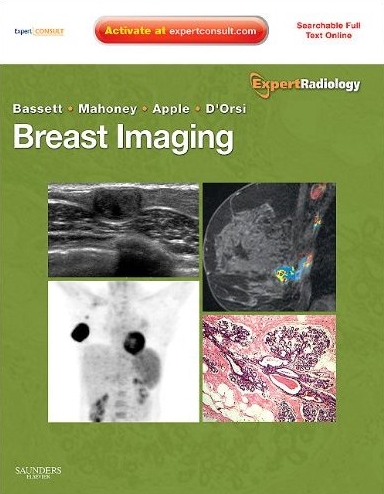 Breast Imaging: Expert Radiology series