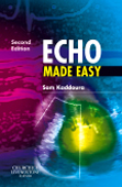 Echo Made Easy 2/e