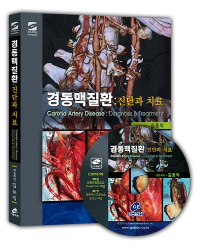 경동맥질환: 진단과치료(DVD포함)