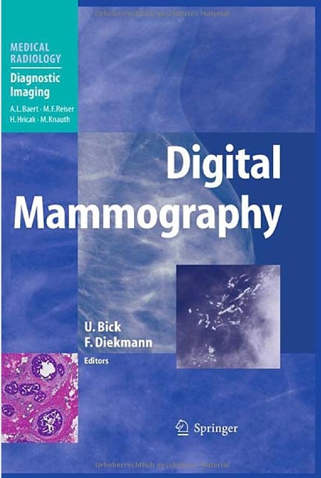 Digital Mammography (Paperback)