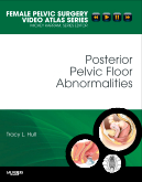 Posterior Pelvic Floor Abnormalities-Female Pelvic Surgery Video Atlas Series