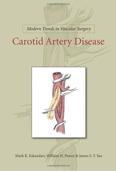 Carotid Artery Disease-1판