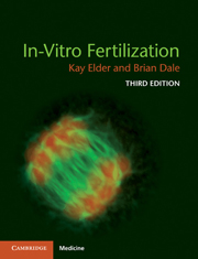 In Vitro Fertilization