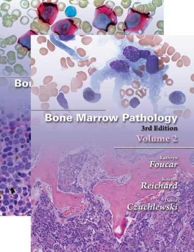 Bone Marrow Pathology Third Edition (2 Vol set)