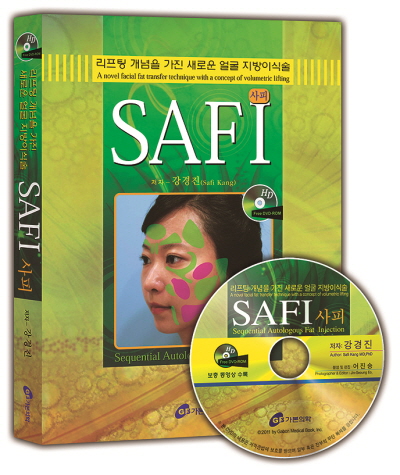 사피(SAFI) - 리프팅개념을 가진 새로운 얼굴지방이식술