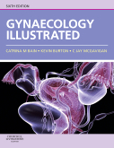 Gynaecology Illustrated 6/e