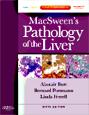 MacSween's Pathology of the Liver 6/e