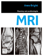 Planning and Positioning in MRI