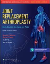Joint Replacement Arthroplasty: Basic Science Hip Knee and Ankle 4/e