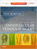 Atlas of Endovascular Venous Surgery-1판
