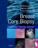 Breast Core Biopsy: A Pathologic-Radiologic Approach