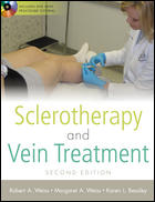 Sclerotherapy and Vein Treatment-2판