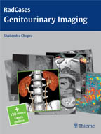 Genitourinary Imaging