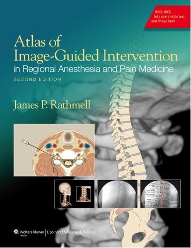 Atlas of Image-Guided Intervention in Regional Anesthesia and Pain Medicine 2/e