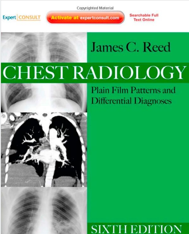 Chest Radiology-6판