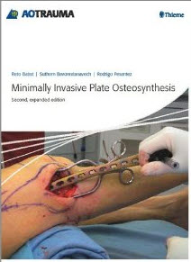 Minimally Invasive Plate Osteosynthesis 2/e (MIPO) (AO Trauma)