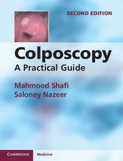 Colposcopy-2판