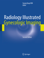 Radiology Illustrated: Gynecologic Imaging 2/e