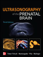 Ultrasonography of the Prenatal Brain-3판