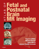 Atlas of Fetal and Postnatal Brain MR 1e