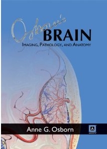 Osborn's Brain: Imaging Pathology and Anatomy
