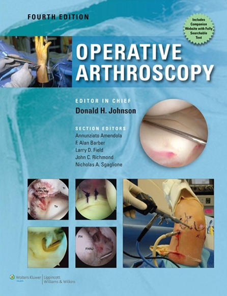 Operative Arthroscopy 4/e