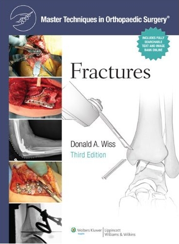 (MTO)Fractures 3/e (Master Techniques in Orthopaedic Surgery)
