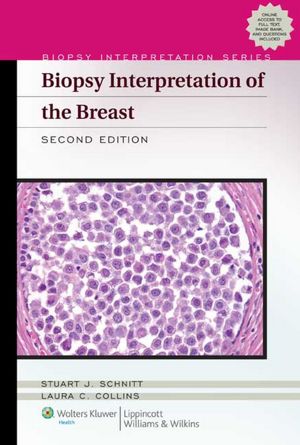 Biopsy Interpretation of the Breast 2/e