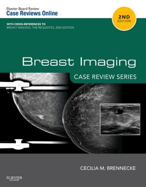 Breast Imaging - Case Review Series 2/e