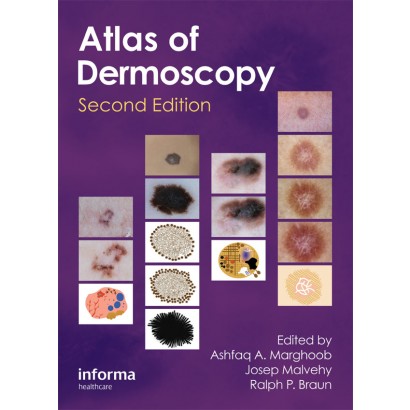 Atlas of Dermoscopy-2판