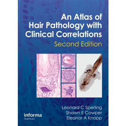 An Atlas of Hair Pathology with Clinical Correlations-2판