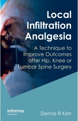 Local Infiltration Analgesia: A Technique for Orthopaedic Surgery of the Hip Knee and Lumbar Spine