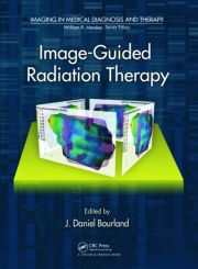 Image-Guided Radiation Therapy-1판