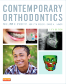 Contemporary Orthodontics 5e [Hardcover]