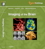 Imaging of the Brain Expert Radiology Series