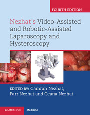 Nezhat's Video-Assisted and Robotic-Assisted Laparoscopy and Hysteroscopy.4/e