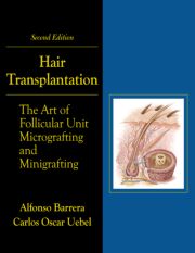 Hair Transplantation: The Art of Micrografting and Minigrafting 2/e (2 DVDs)