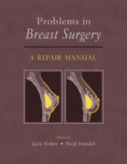 Problems in Breast Surgery: A Repair Manual(2 DVDs)