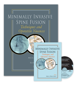 Minimally Invasive Spine Fusion: Techniques and Operative Nuances Book and 2-DVD Set