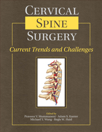 Cervical Spine Surgery: Current Trends and Challenges (2 DVDs)