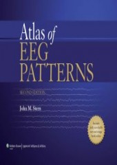 Atlas of EEG Patterns 2/e