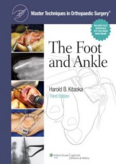 (MTO)Master Techniques in Orthopaedic Surgery: Foot and Ankle 3/e