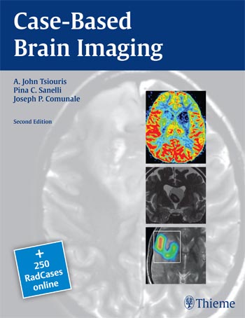 Case-Based Brain Imaging-2판