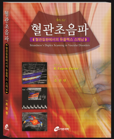 혈관초음파 - 혈관질환에서의 듀플렉스스캐닝-4판