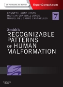 Smith's Recognizable Patterns of Human Malformation-7판