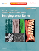 Imaging of the Spine - Expert Radiology Series Expert Consult-Online and Print