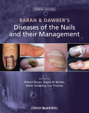 Baran and Dawber's Diseases of the Nails and their Management 4/e