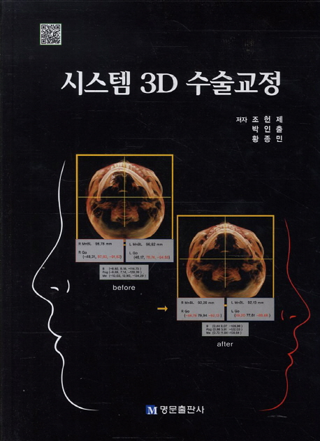 시스템 3D 수술교정