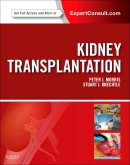 Kidney Transplantation - Principles and Practice-7판